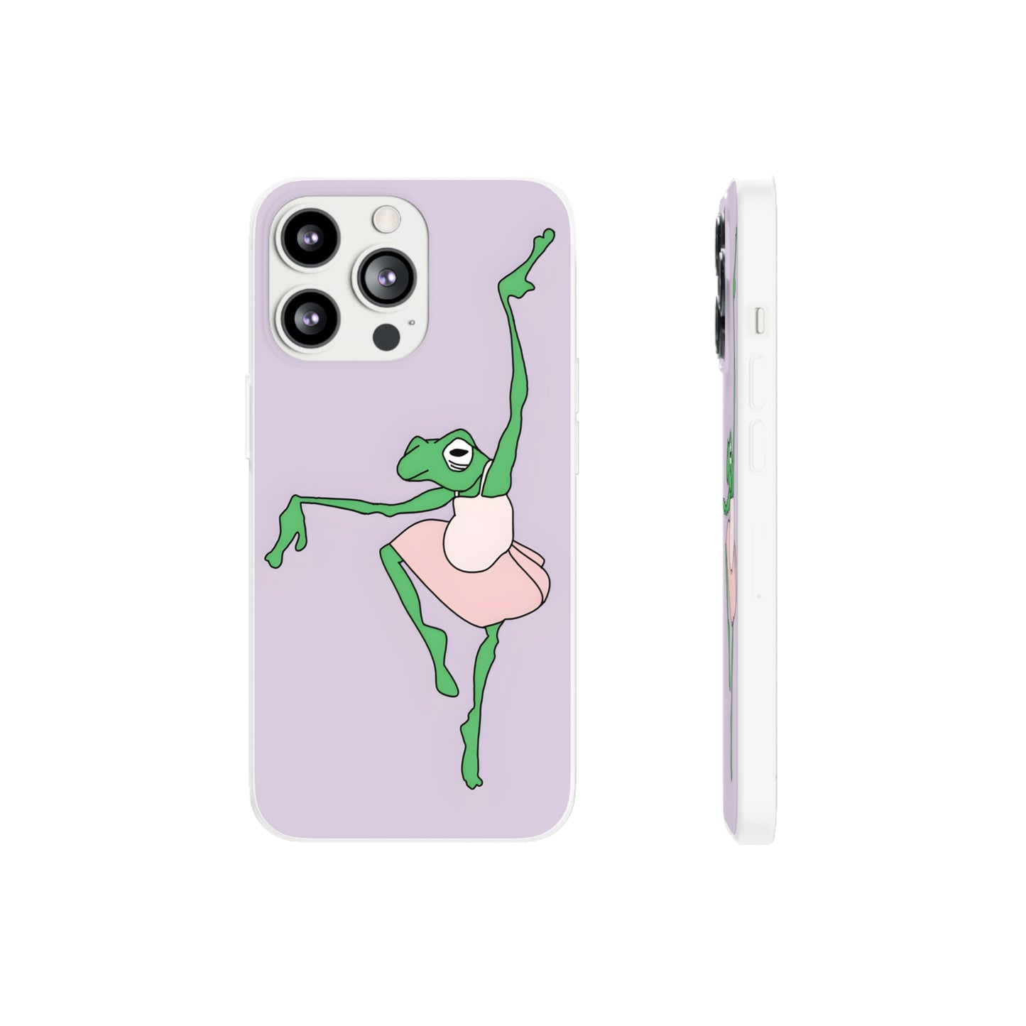 Ballerina Frog iPhone Case