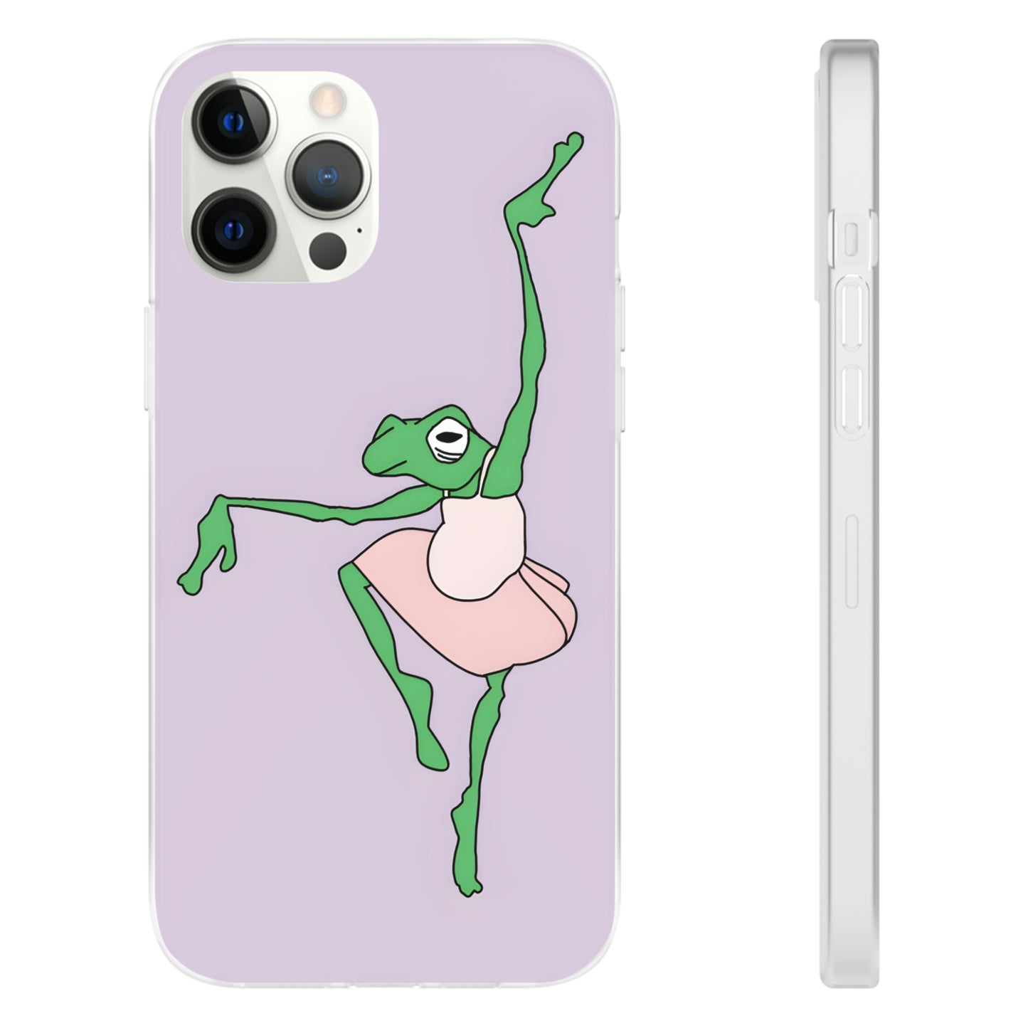 Ballerina Frog iPhone Case