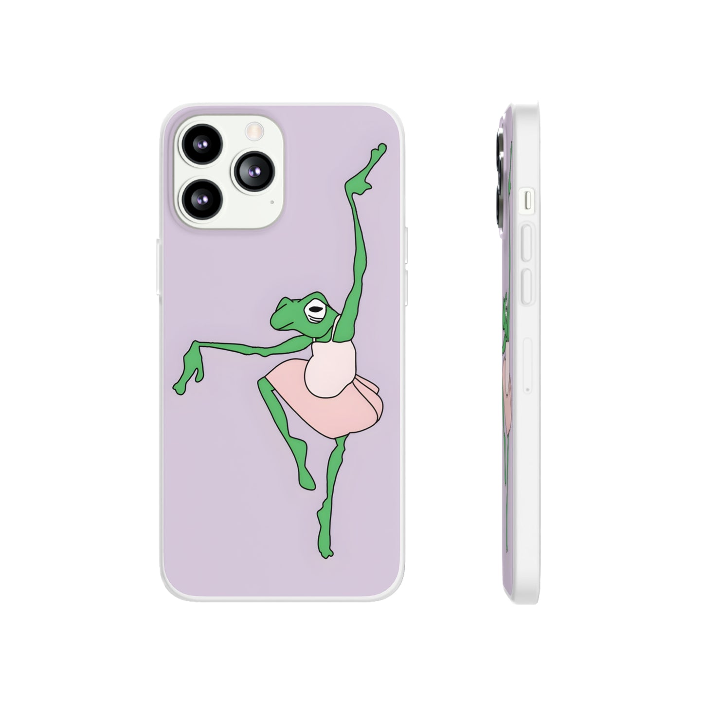 Ballerina Frog iPhone Case