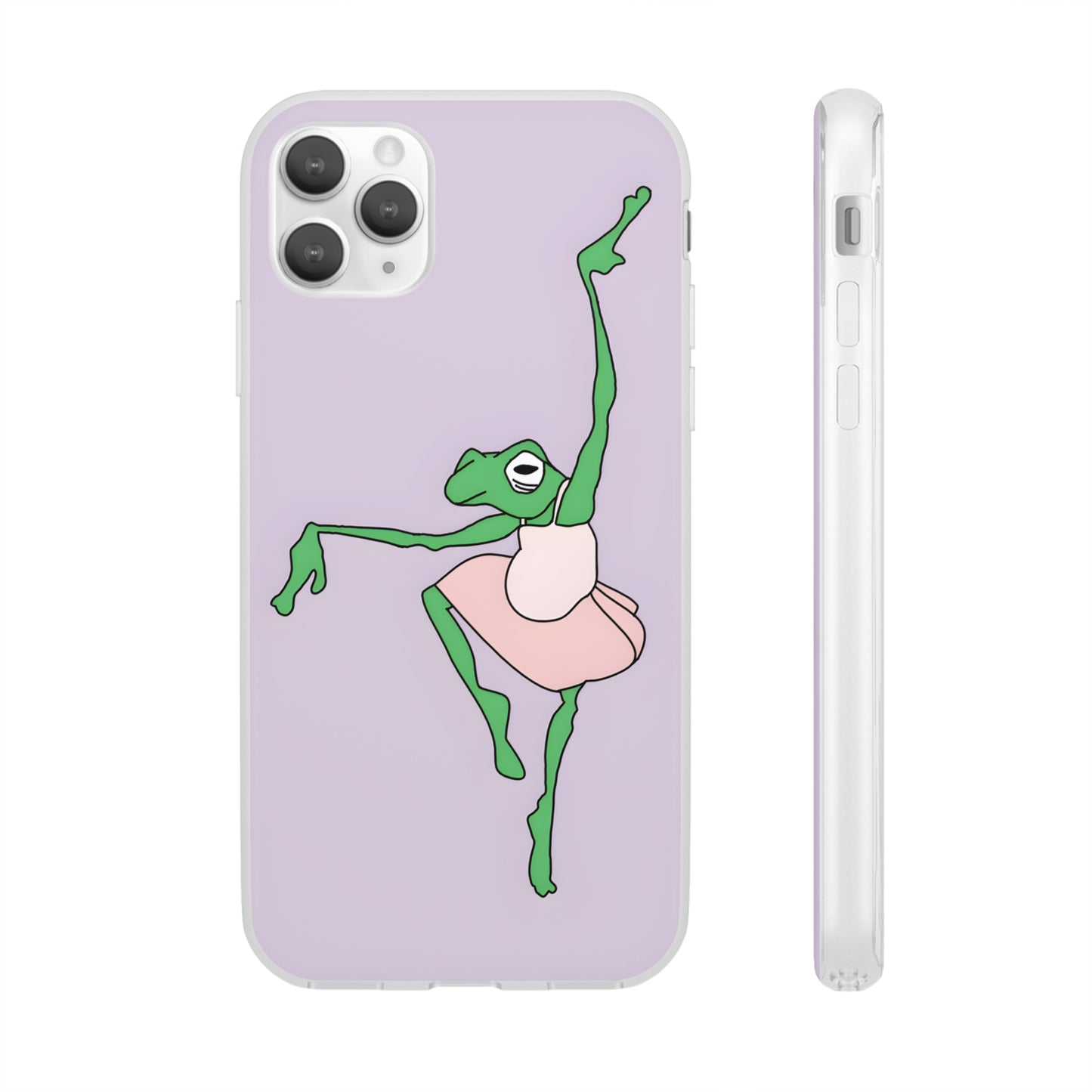 Ballerina Frog iPhone Case